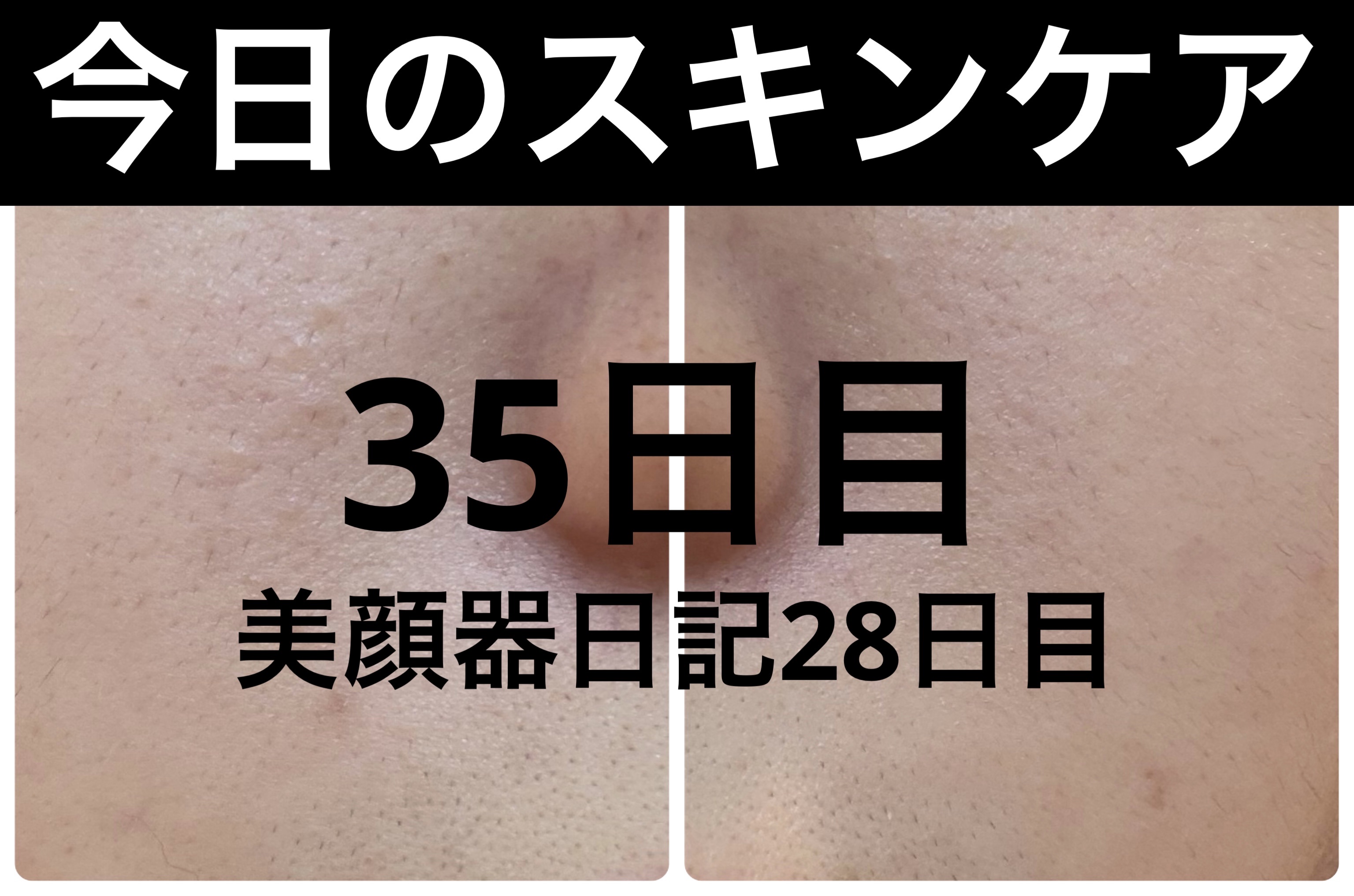 薬用雪肌精 ブライトニング クレンジング オイル[医薬部外品]/雪肌精/オイルクレンジングを使ったクチコミ（1枚目）