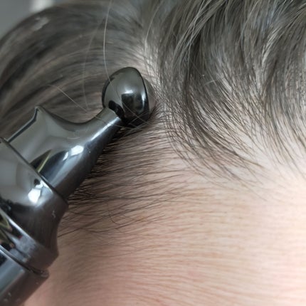 薬用 ヘアグロースエッセンス/john masters organics/頭皮ローションを使ったクチコミ(5枚目)