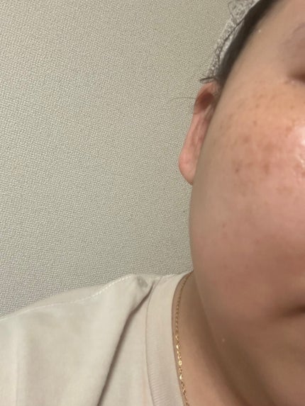 ぴーたろう🐹 on LIPS 「まるで杏仁豆腐のようなゲルマスク/本日は@dr.ninetee..」(4枚目)