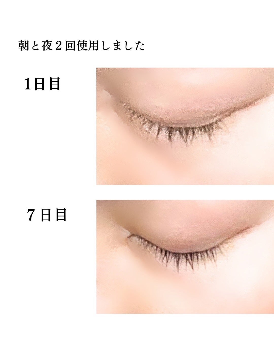 スカルプDまつ毛美容液 クイーン/アンファー(スカルプD)/まつげ美容液を使ったクチコミ(5枚目)