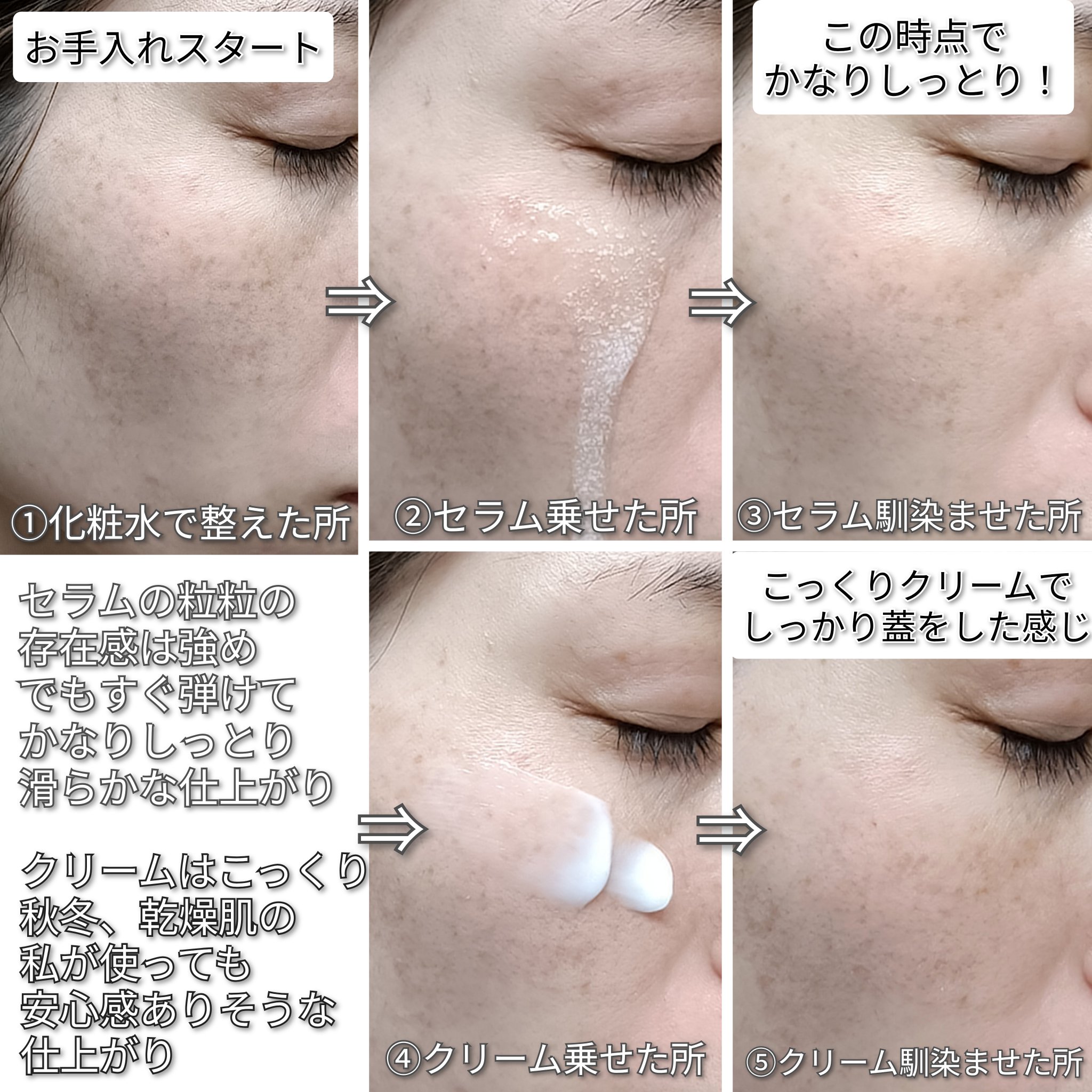 セラメディックス カプセルセラム/MAXCLINIC/美容液を使ったクチコミ（2枚目）