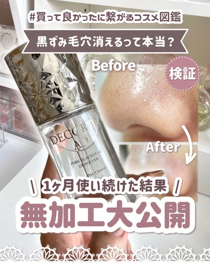 DECORTÉ コスメデコルテ AQ 毛穴美容液オイルのクチコミ「𓊆ㅤコスデコ角栓撲滅オイル本音レポ🔥𓊇1ヶ月使い続けた結果を無加工でお見せします!!!
⟡......」(1枚目)