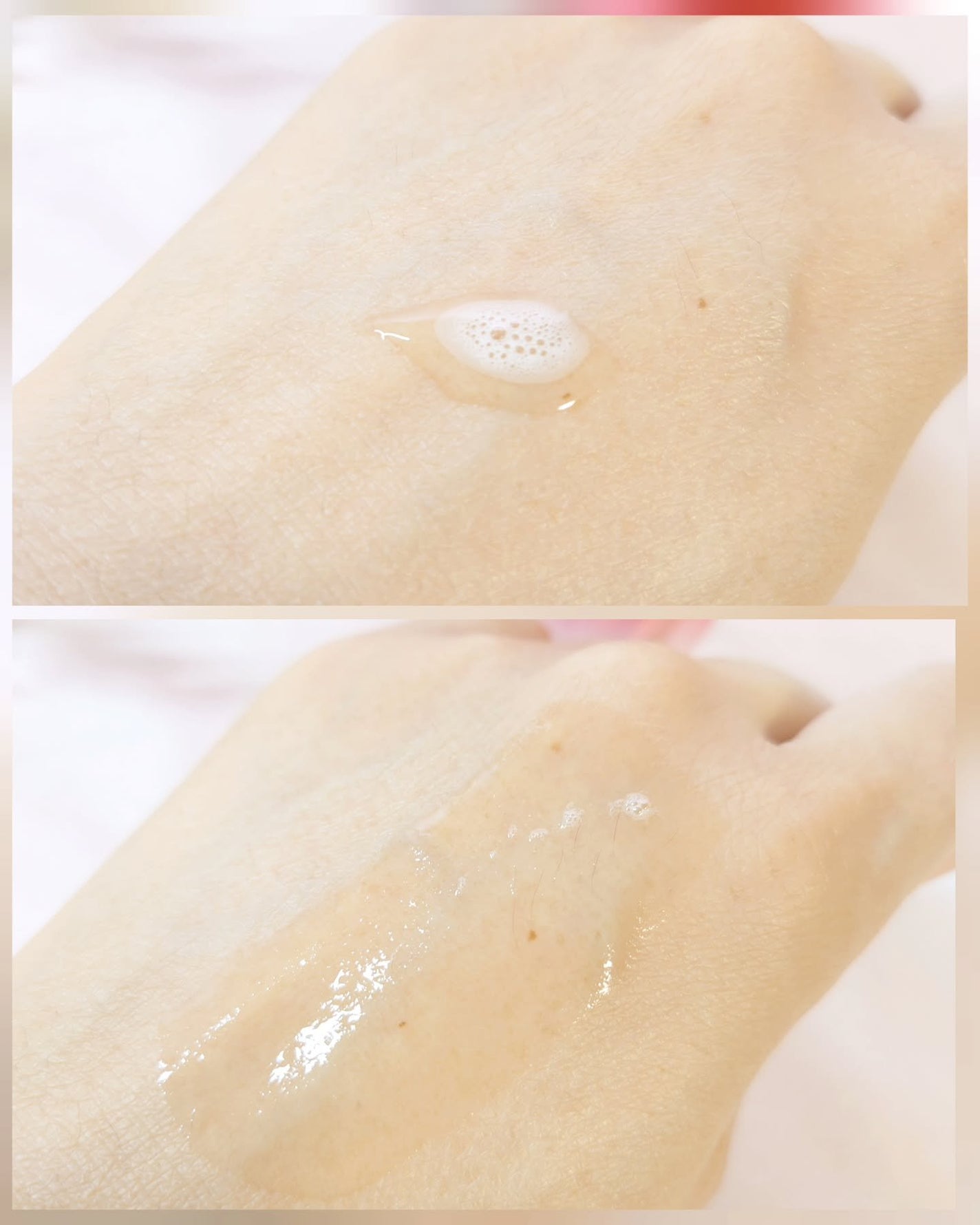 スカルプD ボーテ メディカルエストロジー スカルプセラム/アンファー(スカルプD)/頭皮ローションを使ったクチコミ(3枚目)