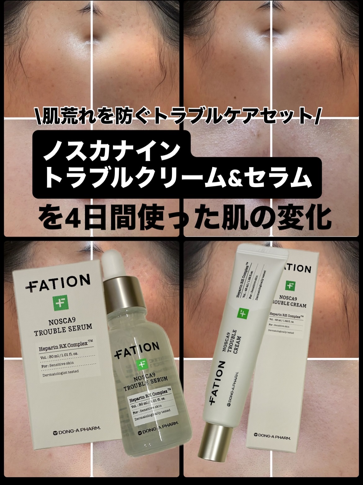 ノスカナイン トラブル セラム/FATION/美容液を使ったクチコミ（1枚目）
