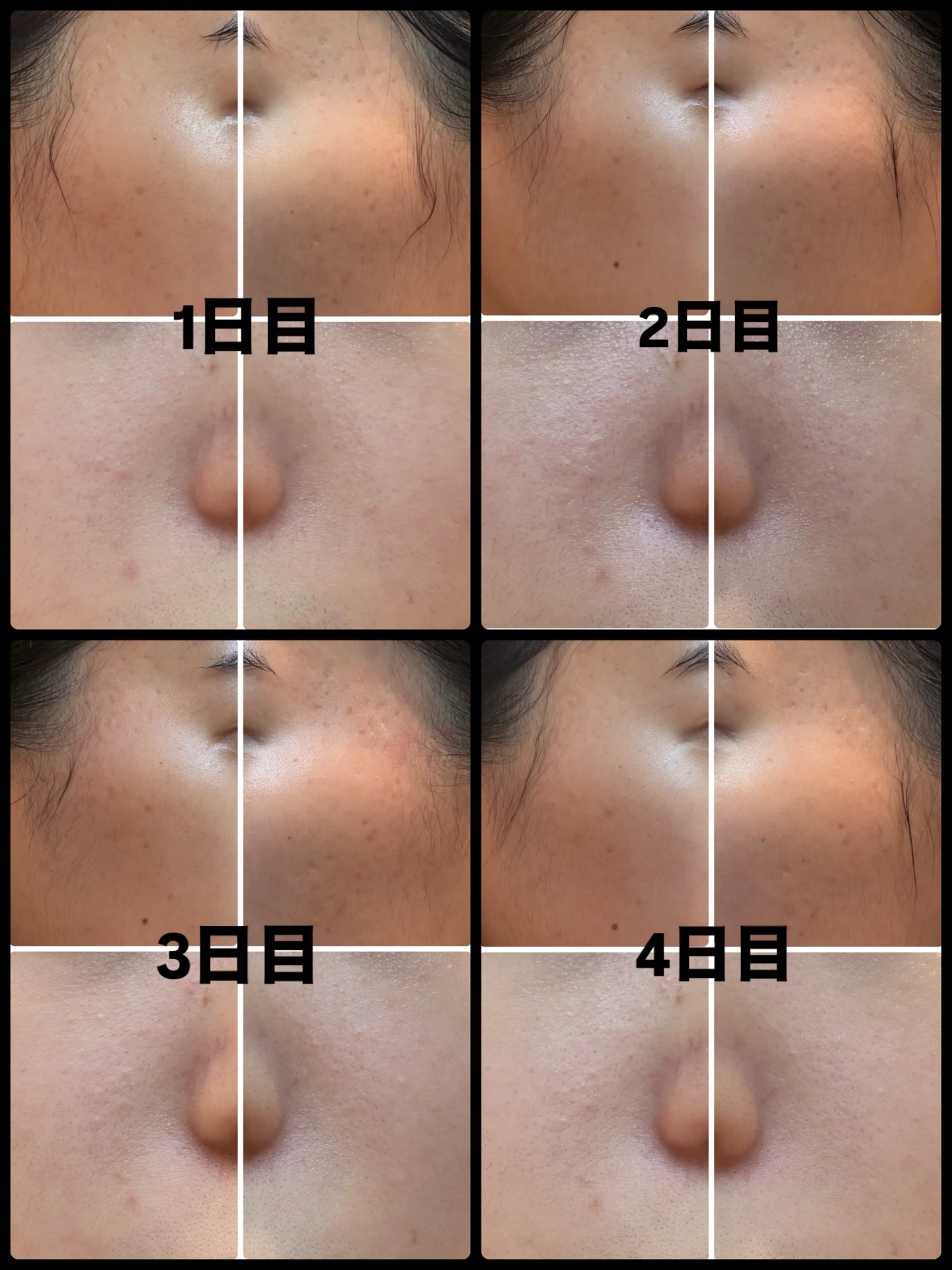 ノスカナイン トラブル セラム/FATION/美容液を使ったクチコミ（3枚目）