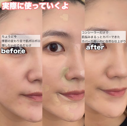 コンシールブレンダーパレット/LUNA/パレットコンシーラーを使ったクチコミ(4枚目)