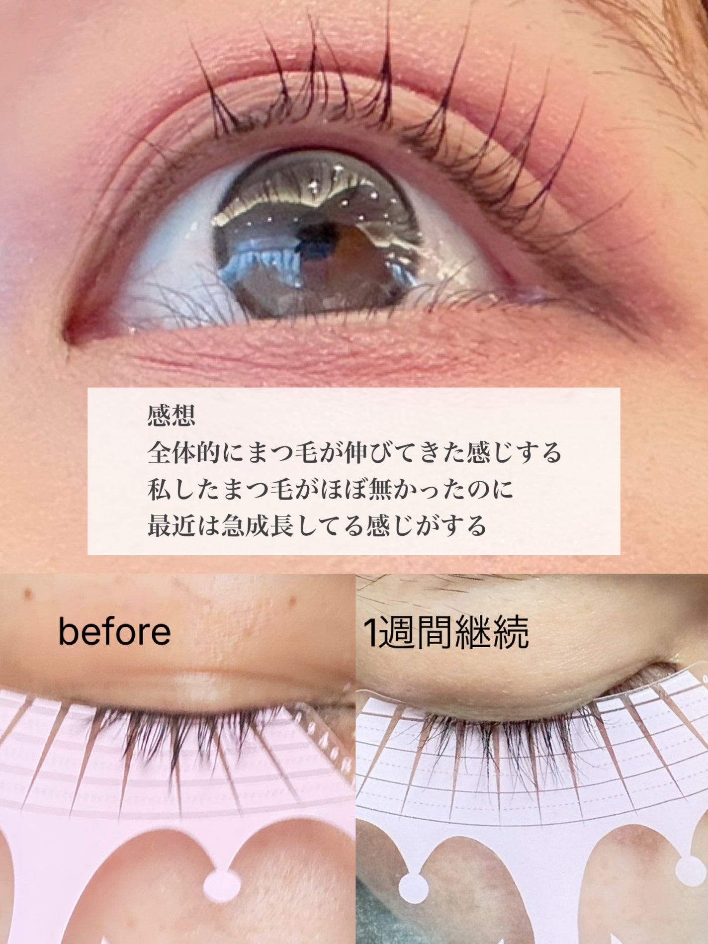 スカルプDまつ毛美容液 クイーン/アンファー(スカルプD)/まつげ美容液を使ったクチコミ(1枚目)