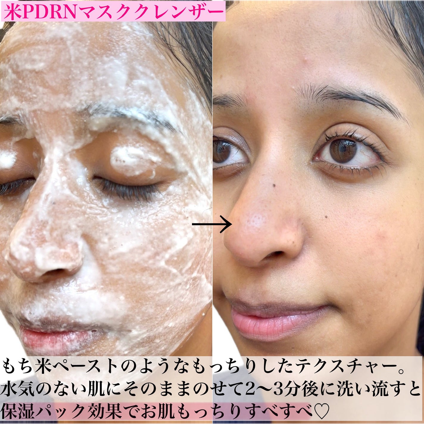 米セラミドカプセルクリーム/FULLY/フェイスクリームを使ったクチコミ(4枚目)