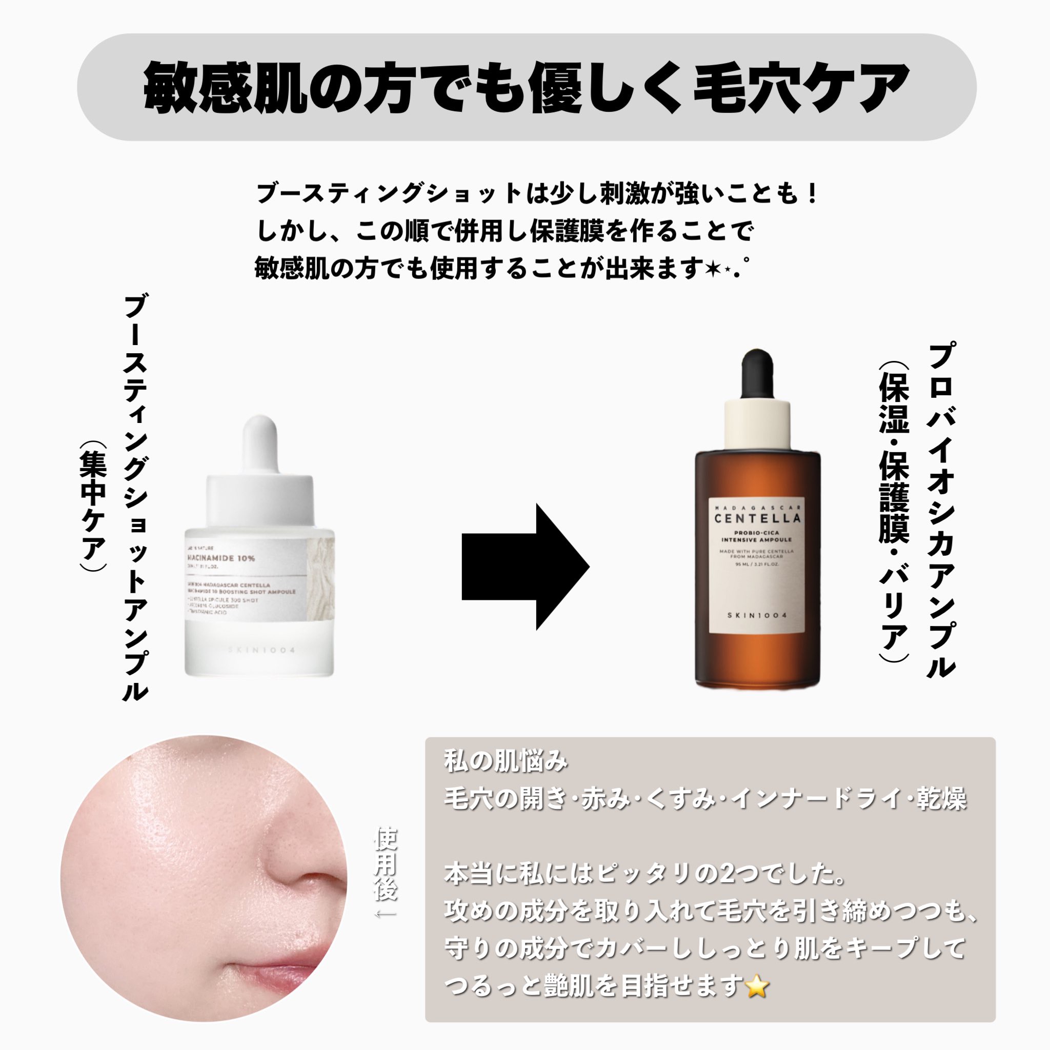 プロバイオシカ インテンシブ アンプル/SKIN1004/美容液を使ったクチコミ（3枚目）