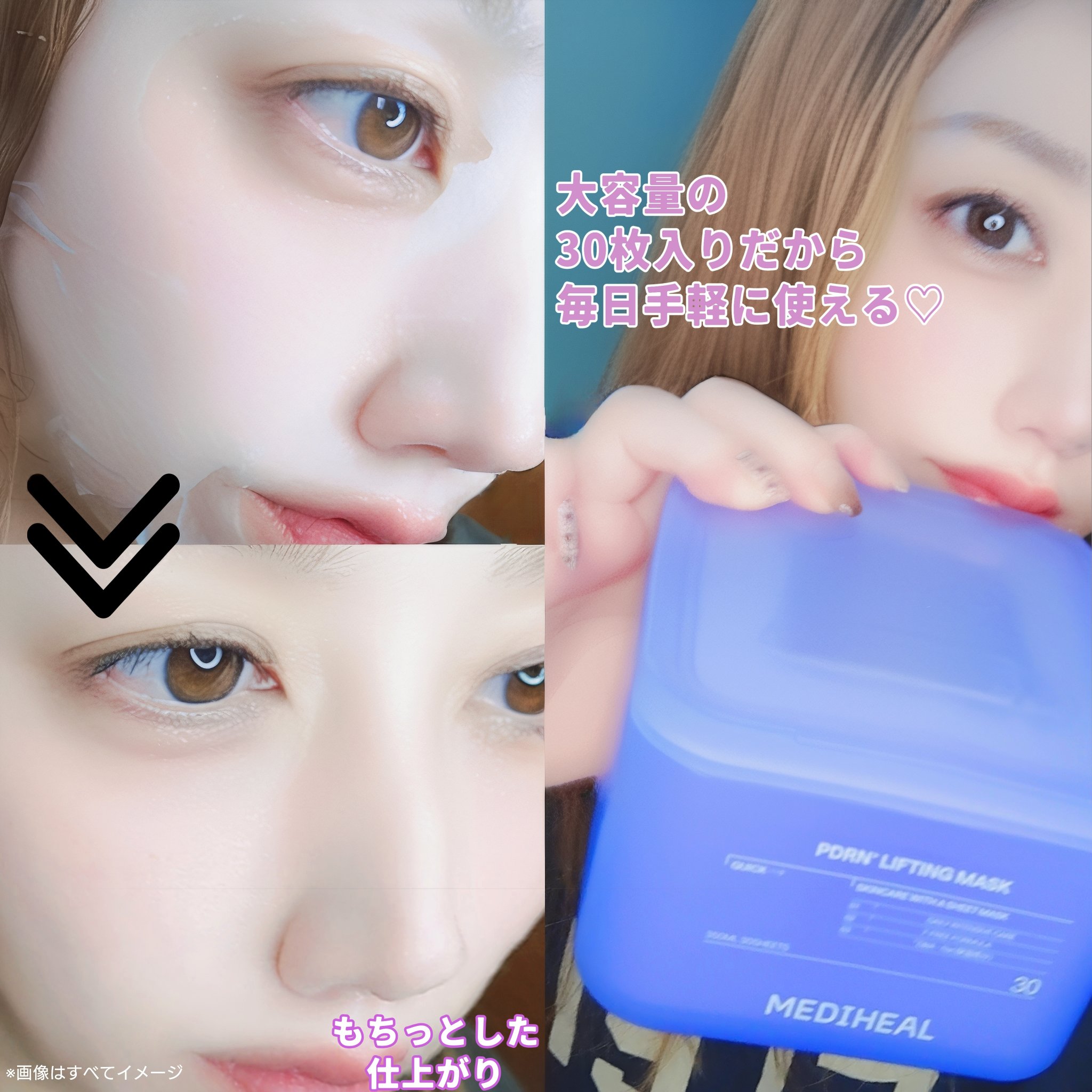 PDRN リフティングマスク/MEDIHEAL/シートマスク・パックを使ったクチコミ（3枚目）