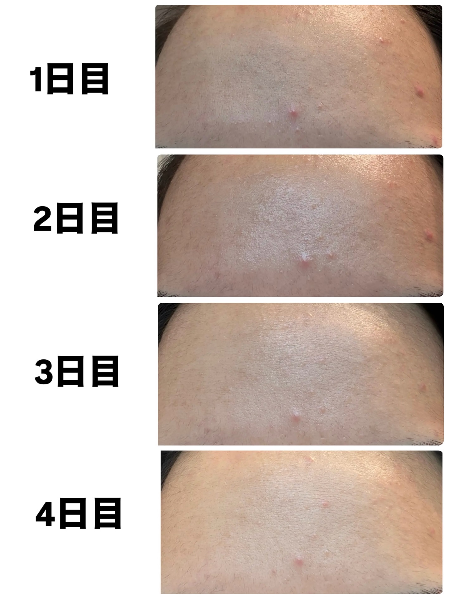 ノスカナイン トラブル セラム/FATION/美容液を使ったクチコミ（2枚目）