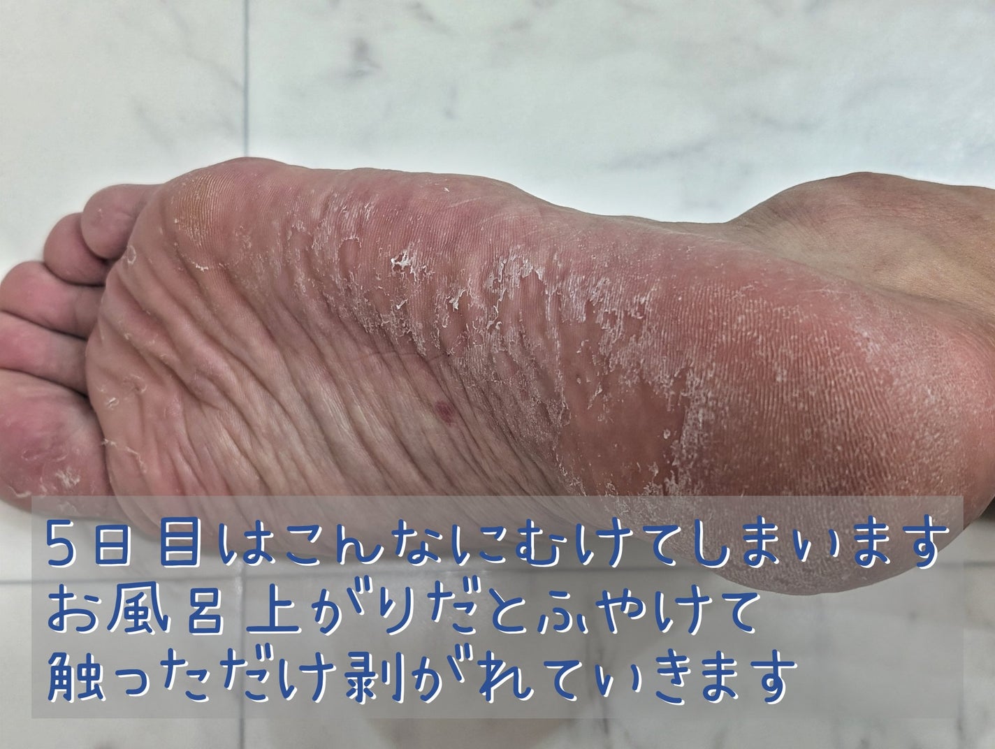 さらばっ角質エキスプレス/MYM/レッグ・フットケアを使ったクチコミ(4枚目)