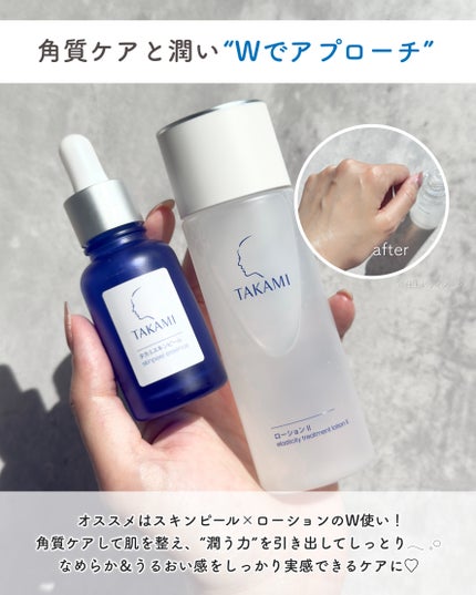タカミローション Ⅰ/タカミ/化粧水を使ったクチコミ(5枚目)