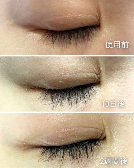 アイラッシュエッセンシャルセラム/epais/まつげ美容液を使ったクチコミ(7枚目)