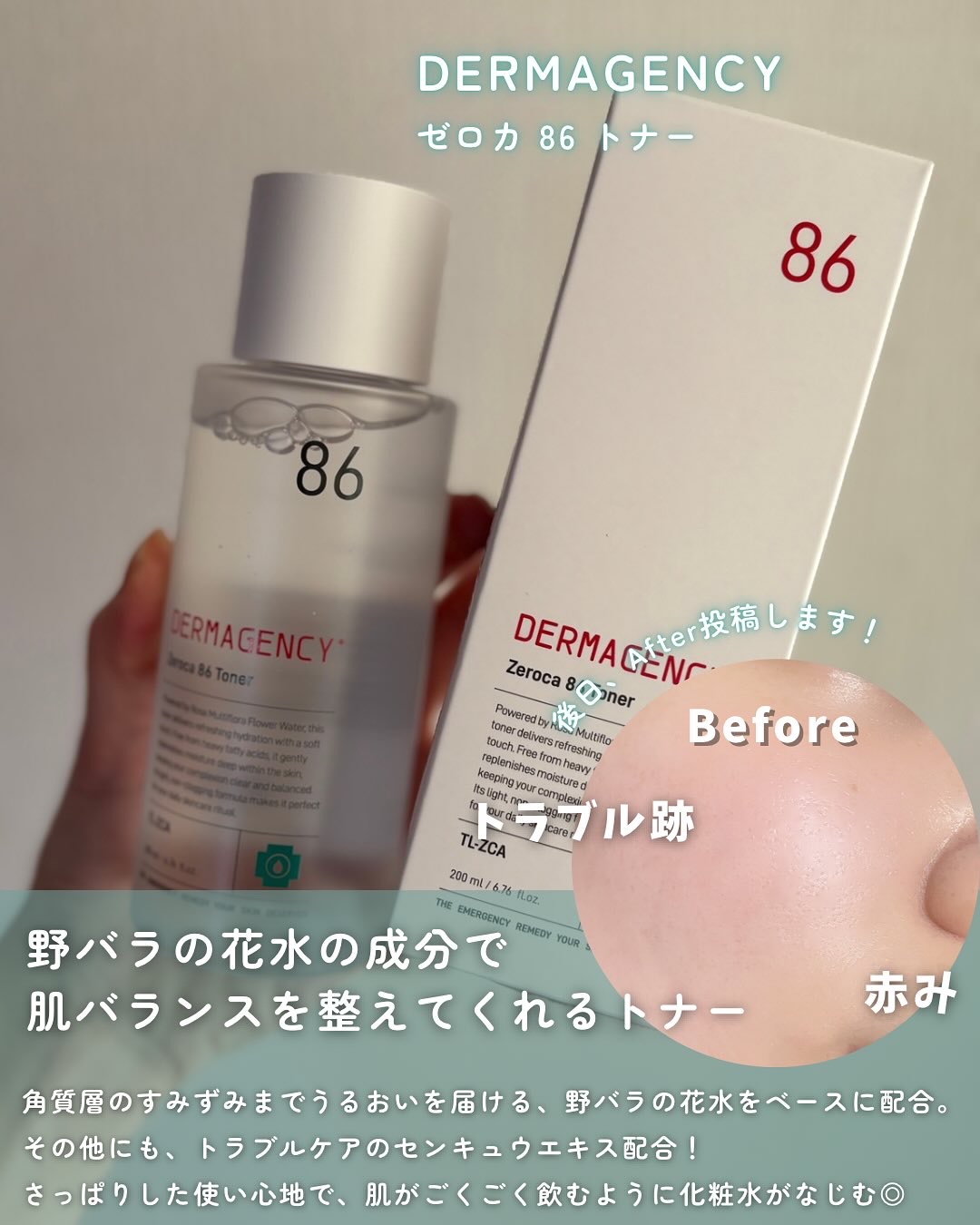 ダーマジェンシー ゼロカ86 トナー/DERMAGENCY/化粧水を使ったクチコミ（3枚目）