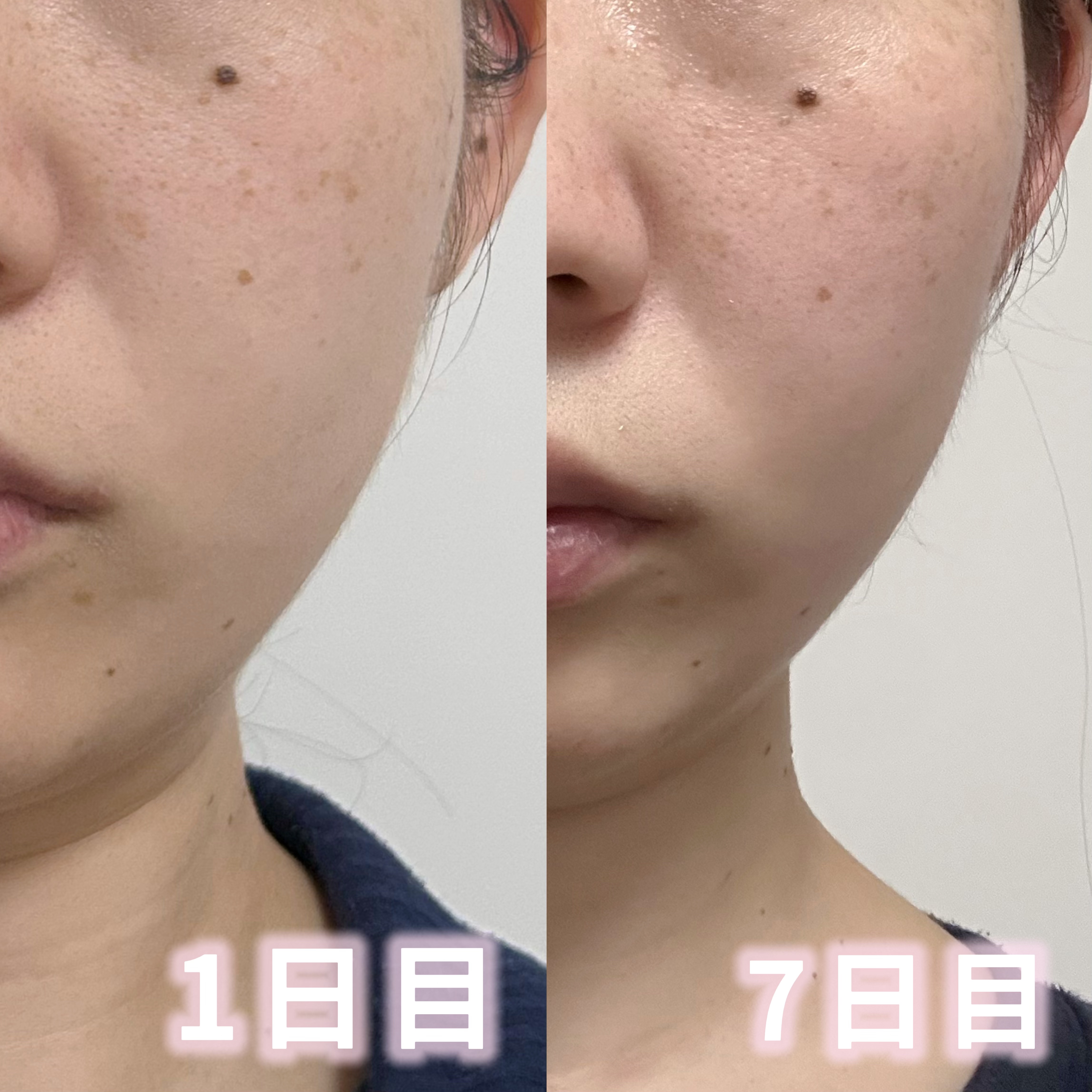 AGE-R ブースタープロ/MEDICUBE/美顔器・マッサージを使ったクチコミ（2枚目）