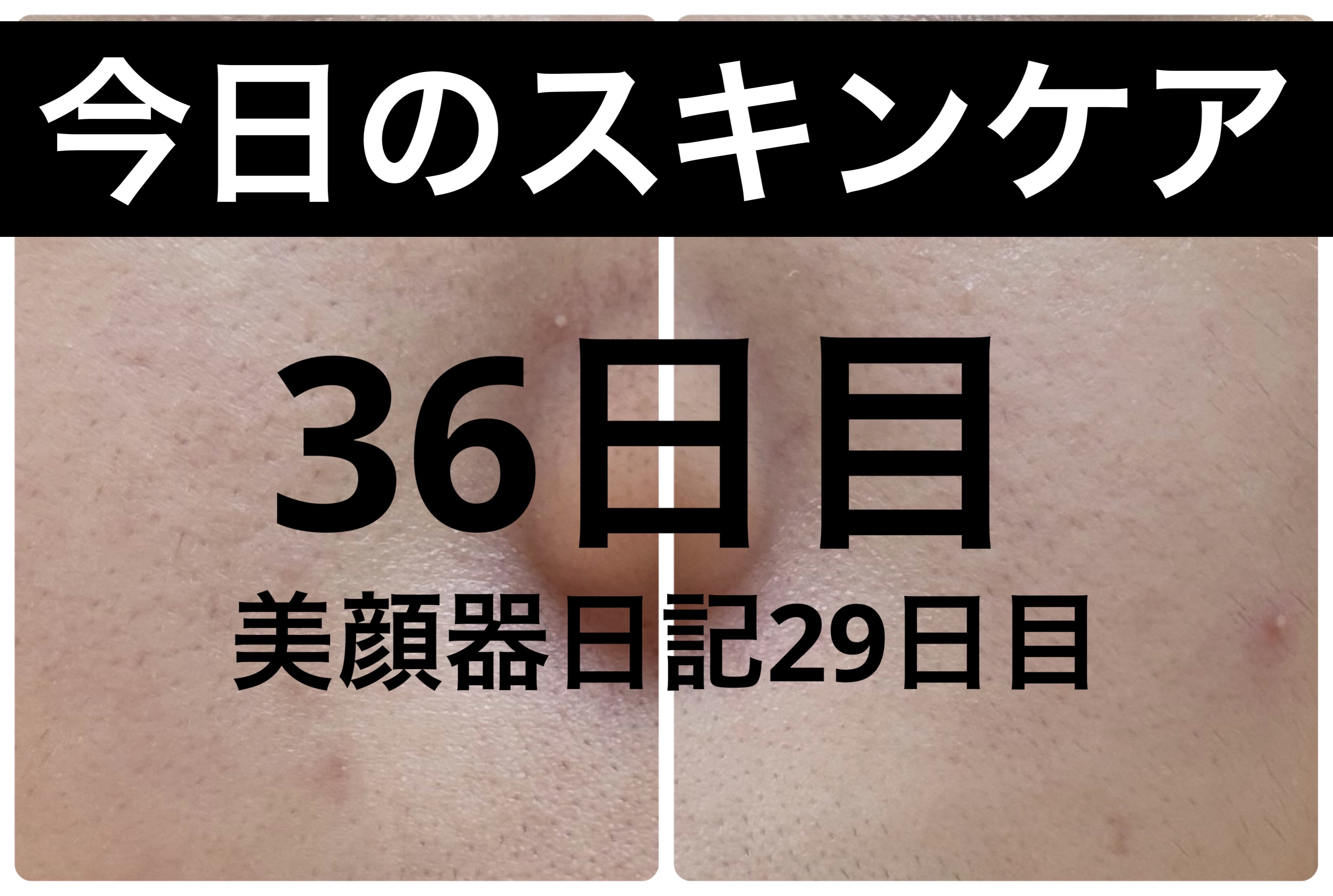 薬用雪肌精 ブライトニング クレンジング オイル[医薬部外品]/雪肌精/オイルクレンジングを使ったクチコミ（1枚目）