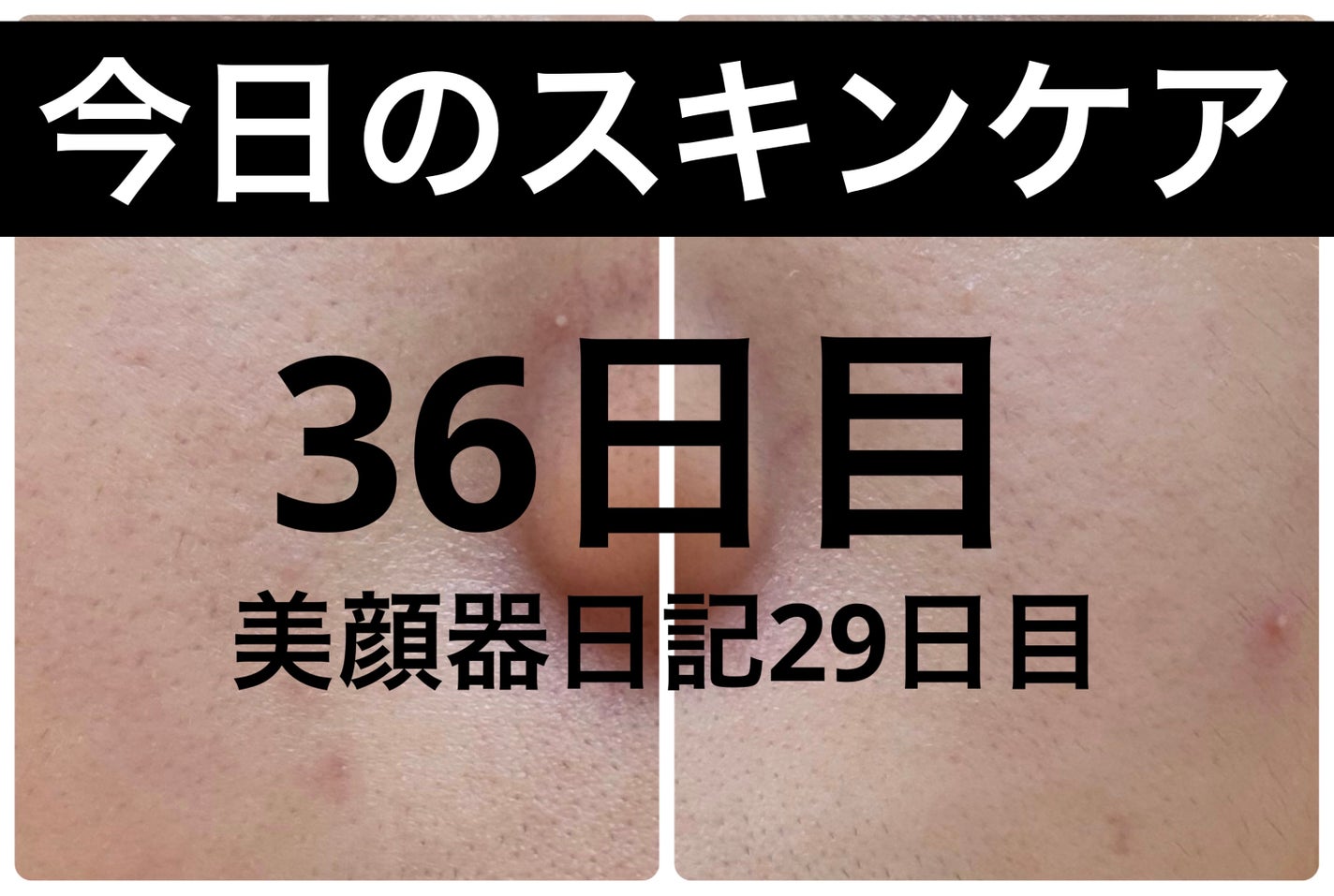 AGE-R ブースタープロ/MEDICUBE/美顔器・マッサージを使ったクチコミ(1枚目)