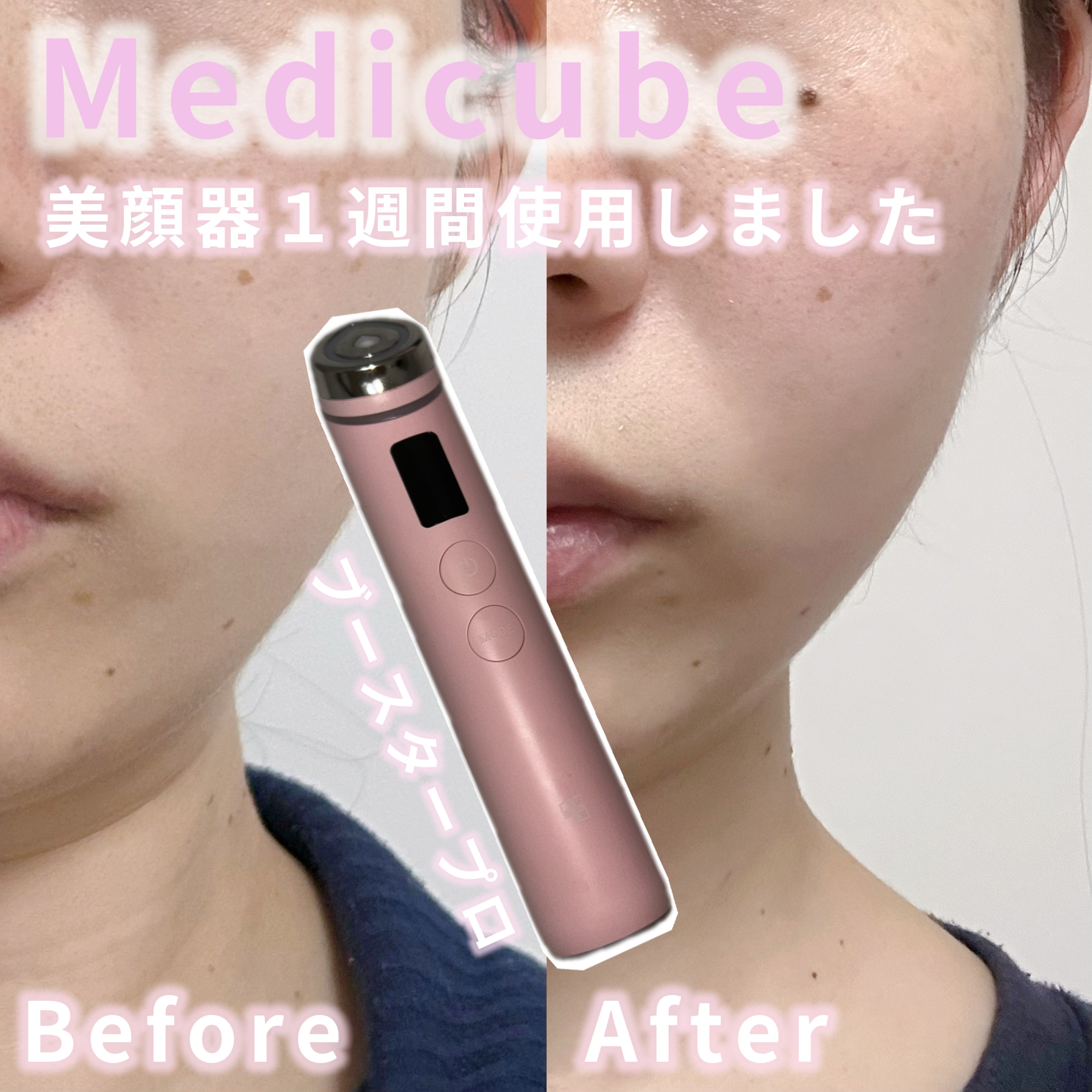 AGE-R ブースタープロ/MEDICUBE/美顔器・マッサージを使ったクチコミ（1枚目）