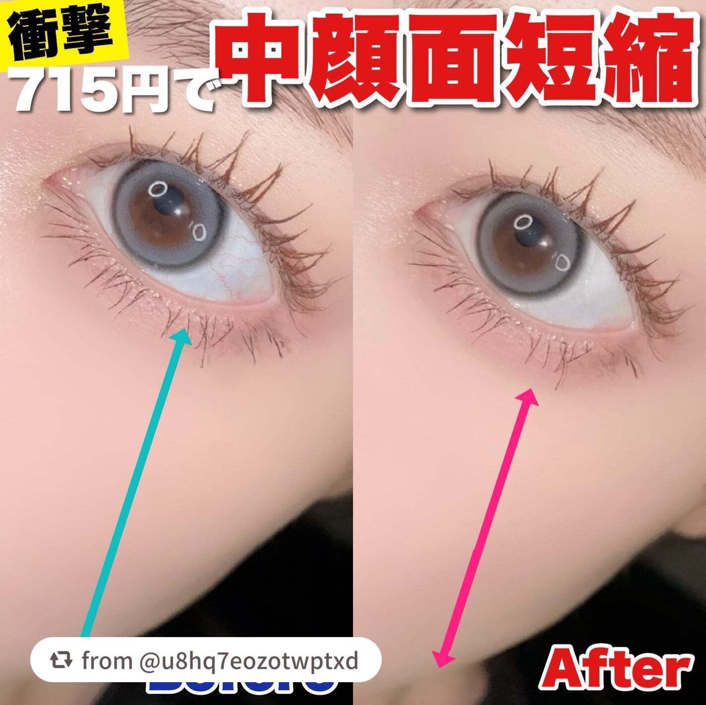 素敵な投稿をありがとうございます✨

発売中のアイバッグコンシーラー 04
チェックしていただいておりますでしょうか👀

明るい涙袋は浮いてしまう！
なんだか似合わない…
そう思っていた方に、是非お試しいただきたいです✨

落ち着いたロー