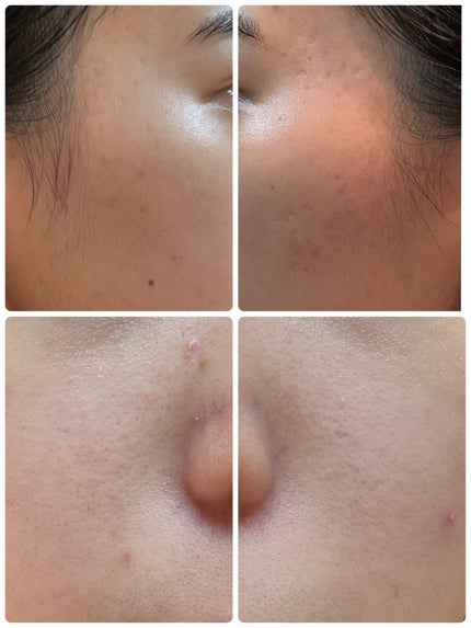 エターナルアイクリーム/リュバンブラン/アイケア・アイクリームを使ったクチコミ(2枚目)