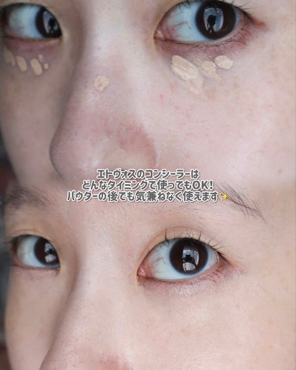 ミネラルインナートリートメントリキッドコンシーラー/エトヴォス/リキッドコンシーラーを使ったクチコミ(5枚目)