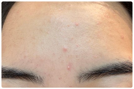 エターナルアイクリーム/リュバンブラン/アイケア・アイクリームを使ったクチコミ(3枚目)