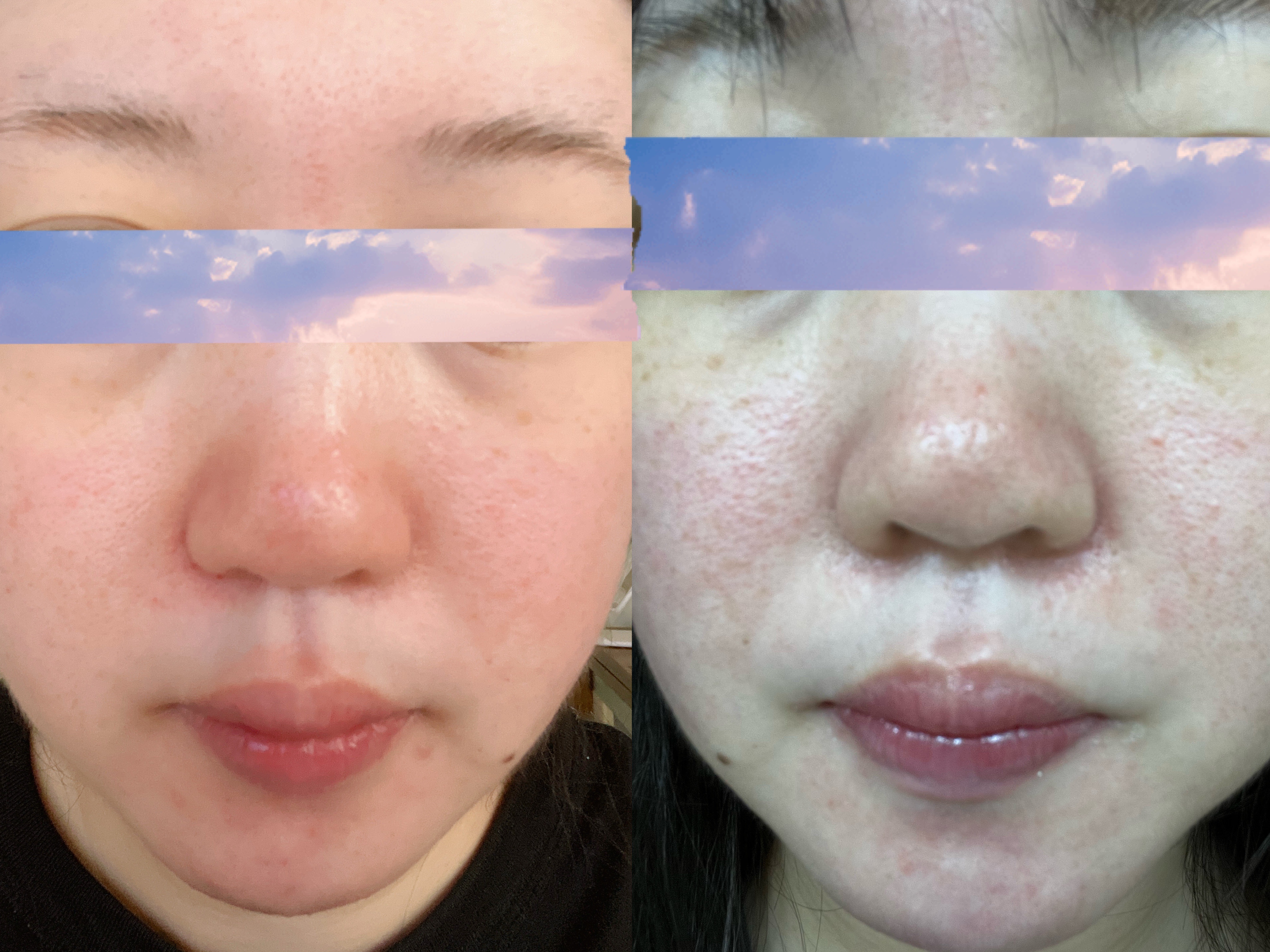 プロバイオシカ インテンシブ アンプル/SKIN1004/美容液を使ったクチコミ（2枚目）