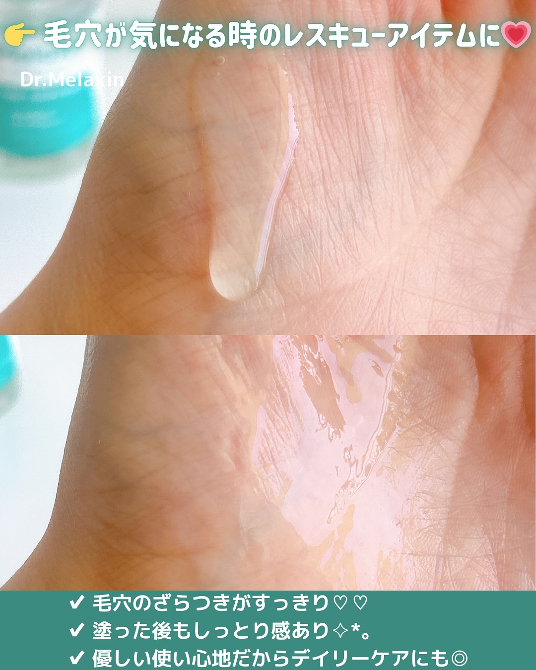 BP-PORE AMPOULE /Dr.Melaxin/美容液を使ったクチコミ（3枚目）