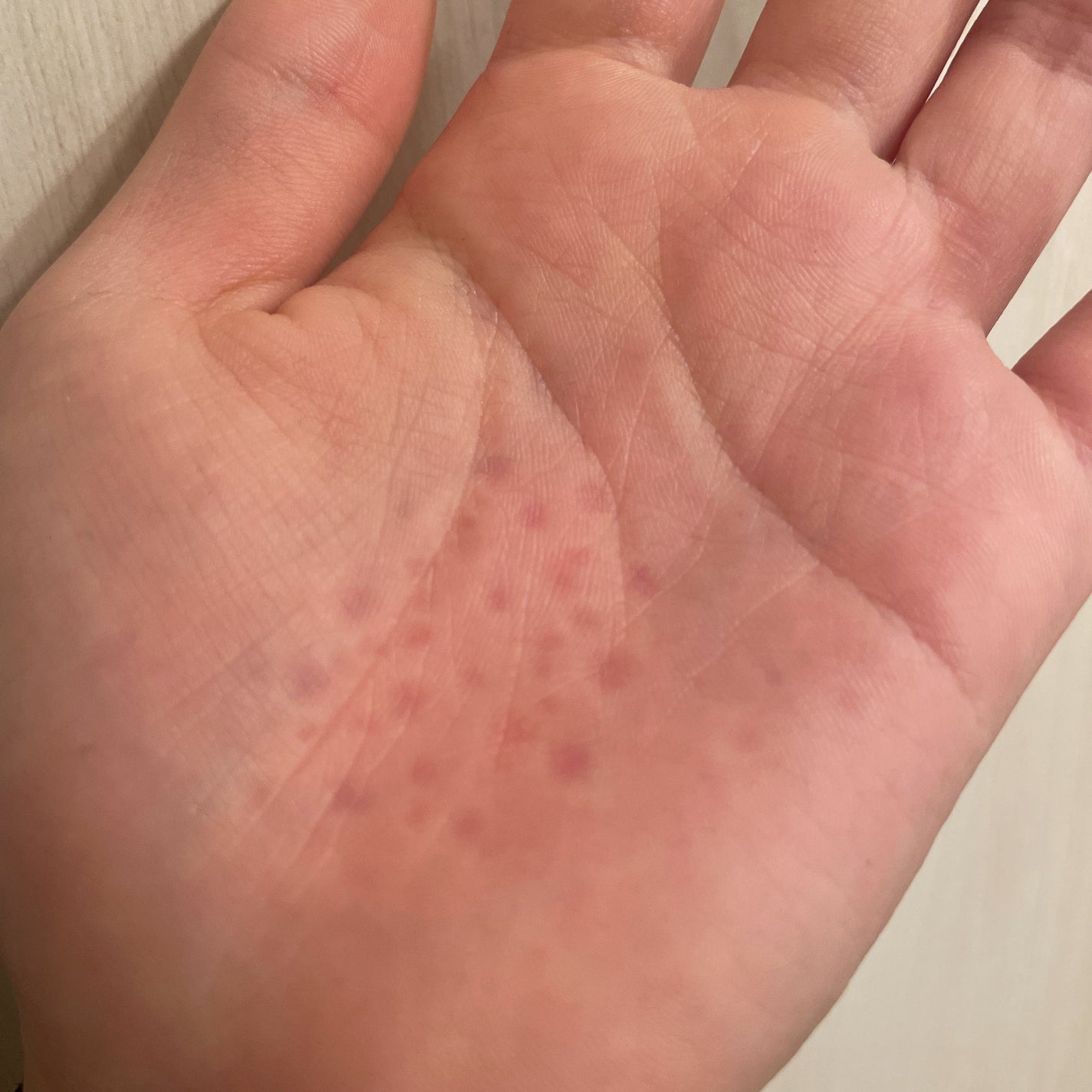 エイトザタラソ ユー CBD&スパークリング ヘッドスパ スキャルプエッセンス/エイトザタラソ/頭皮ローションを使ったクチコミ(3枚目)