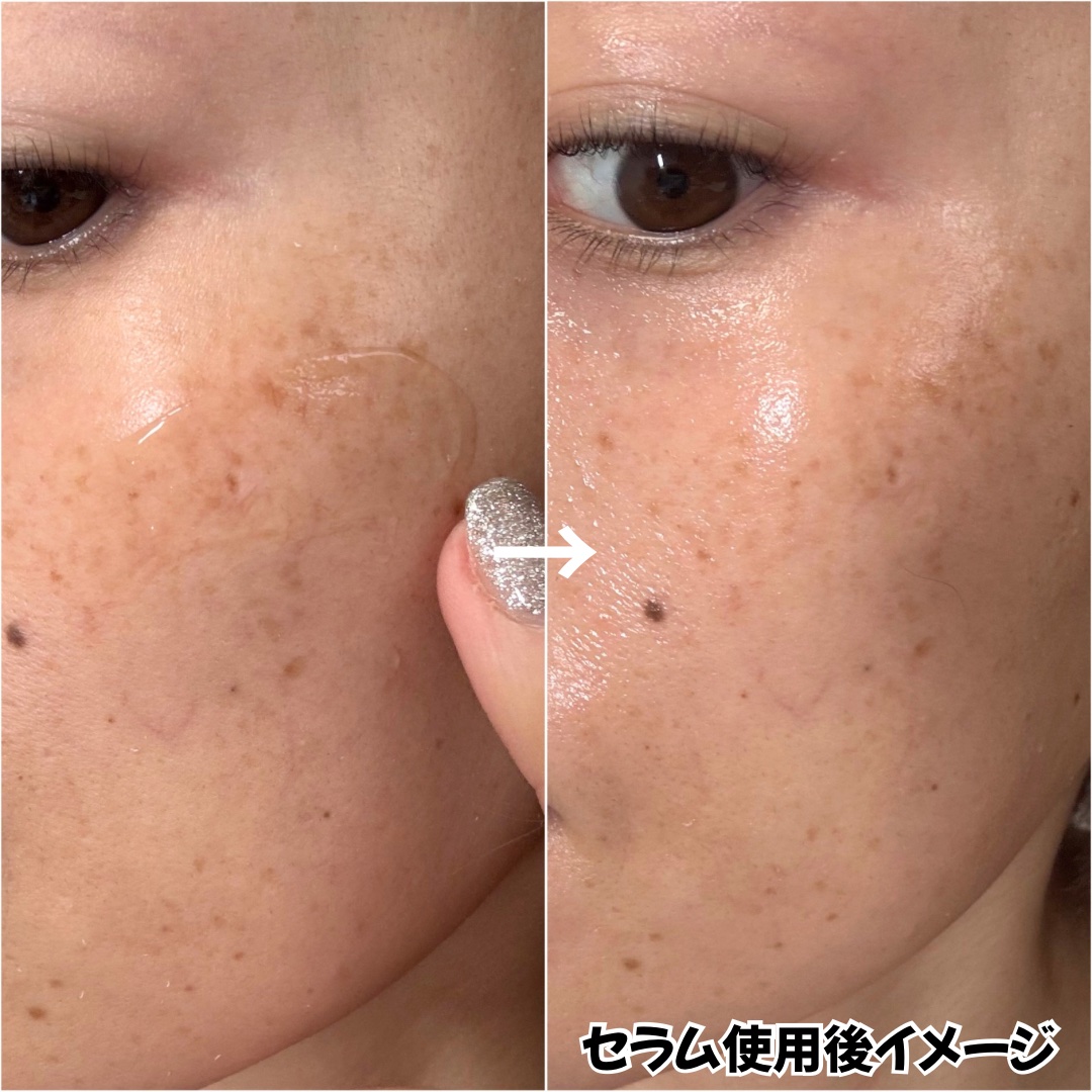 360度ショットPDRNアクティブセラム/センテリアン24/美容液を使ったクチコミ（3枚目）