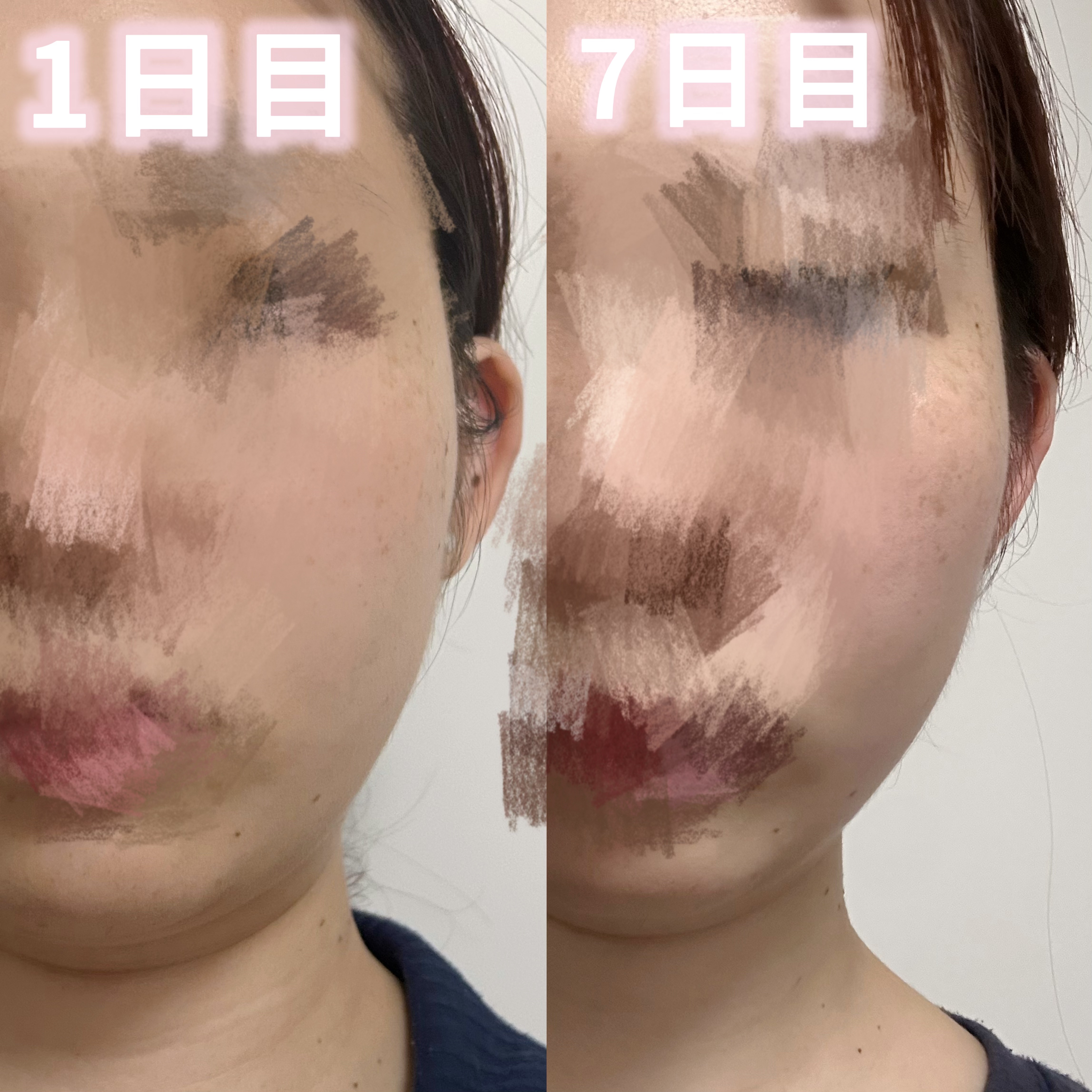 AGE-R ブースタープロ/MEDICUBE/美顔器・マッサージを使ったクチコミ（3枚目）