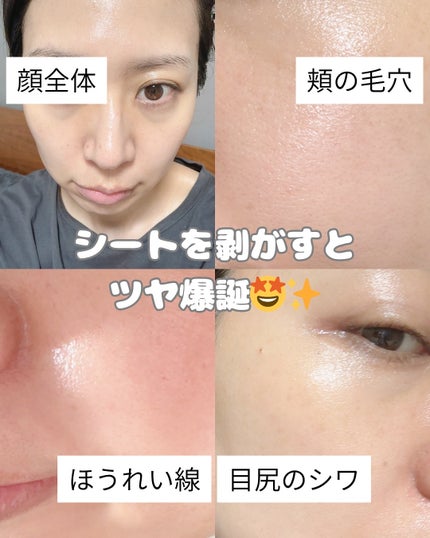 プライベートマスク/DEWYCEL/シートマスク・パックを使ったクチコミ(8枚目)