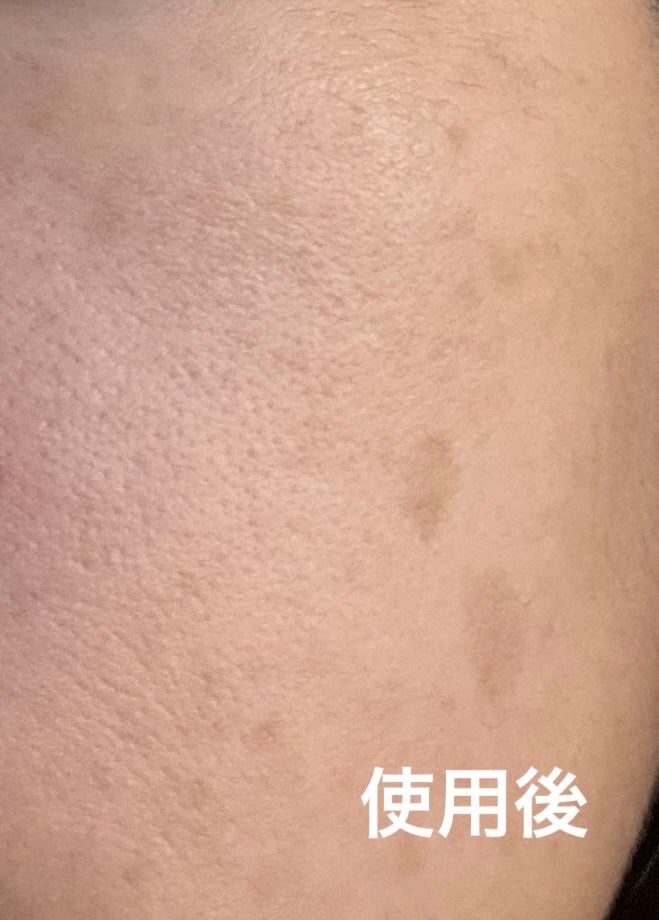 ラネージュ ネオクッション ミュイ /LANEIGE/クッションファンデーションを使ったクチコミ(7枚目)