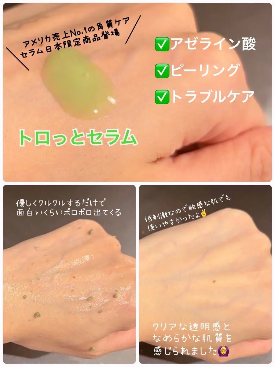 アゼライン酸ゴマージュピーリングセラム/Dr.Melaxin/美容液を使ったクチコミ(3枚目)