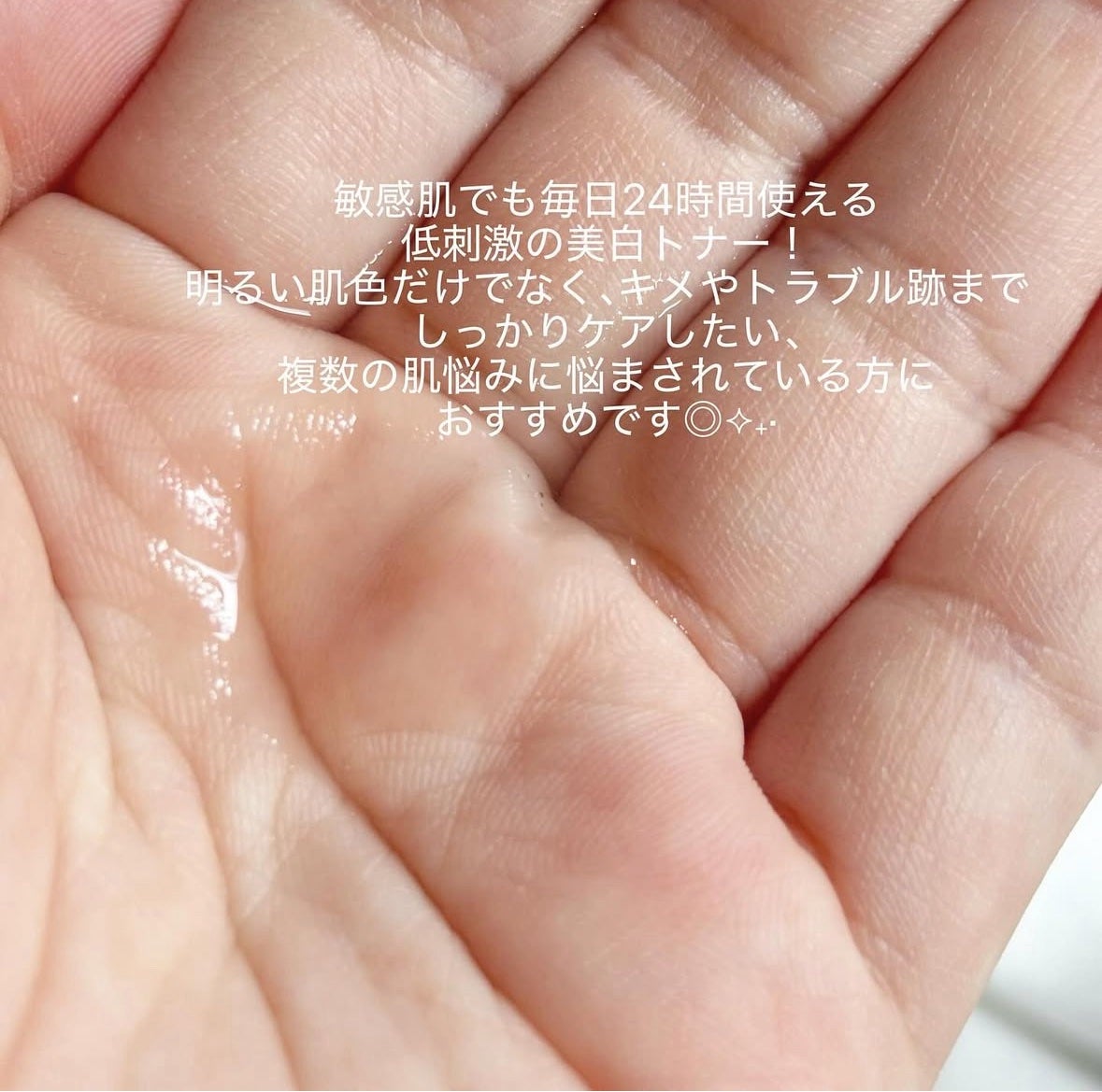 ビタ3オーロラトナー/オーズナリー/化粧水を使ったクチコミ(5枚目)