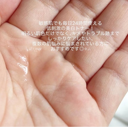 ビタ3オーロラトナー/オーズナリー/化粧水を使ったクチコミ(5枚目)