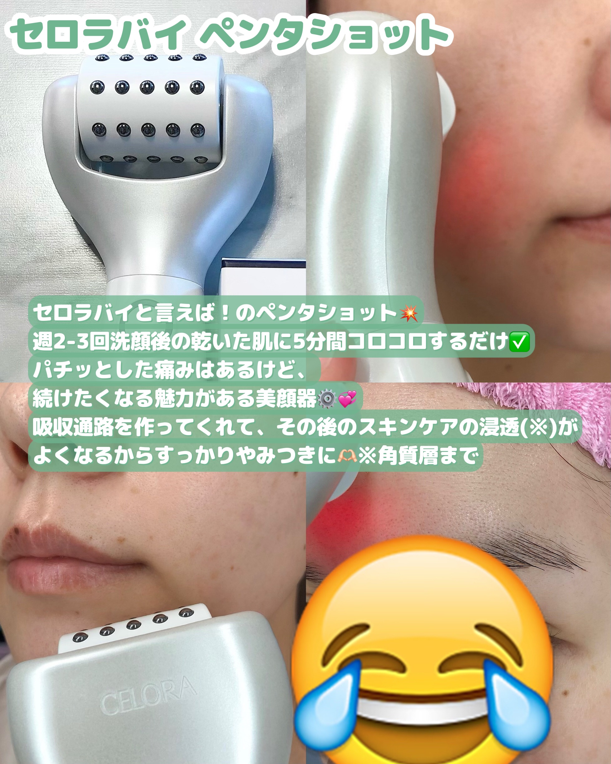 ペンタショット/CELORABY/美顔器・マッサージを使ったクチコミ（2枚目）