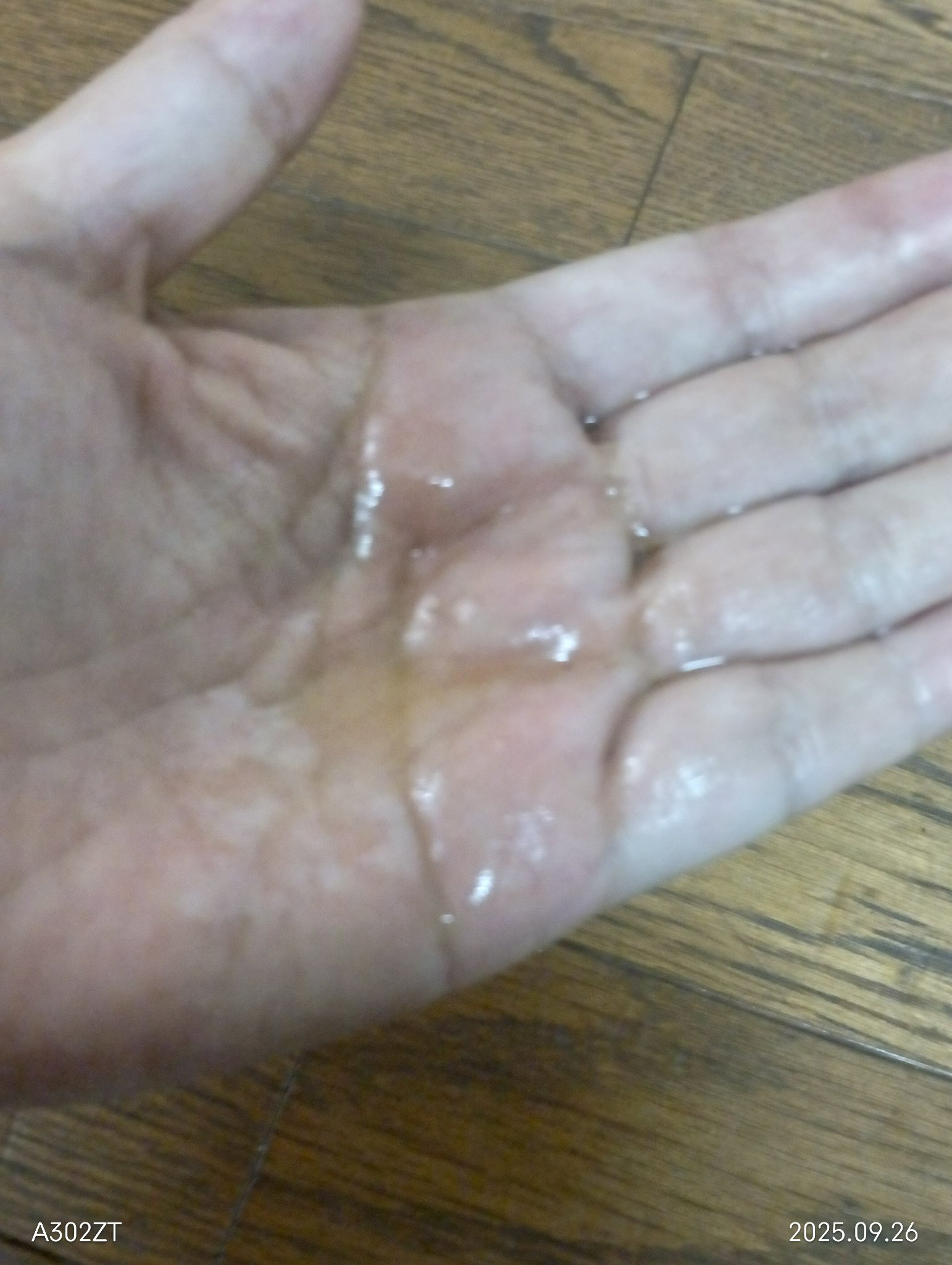 日本創健 ナチュラル馬油のクチコミ「先日久しぶりに化粧品かぶれを起こし
私の救世主・馬油を朝晩塗りました。

そしたらなんと❗️た.....」（3枚目）