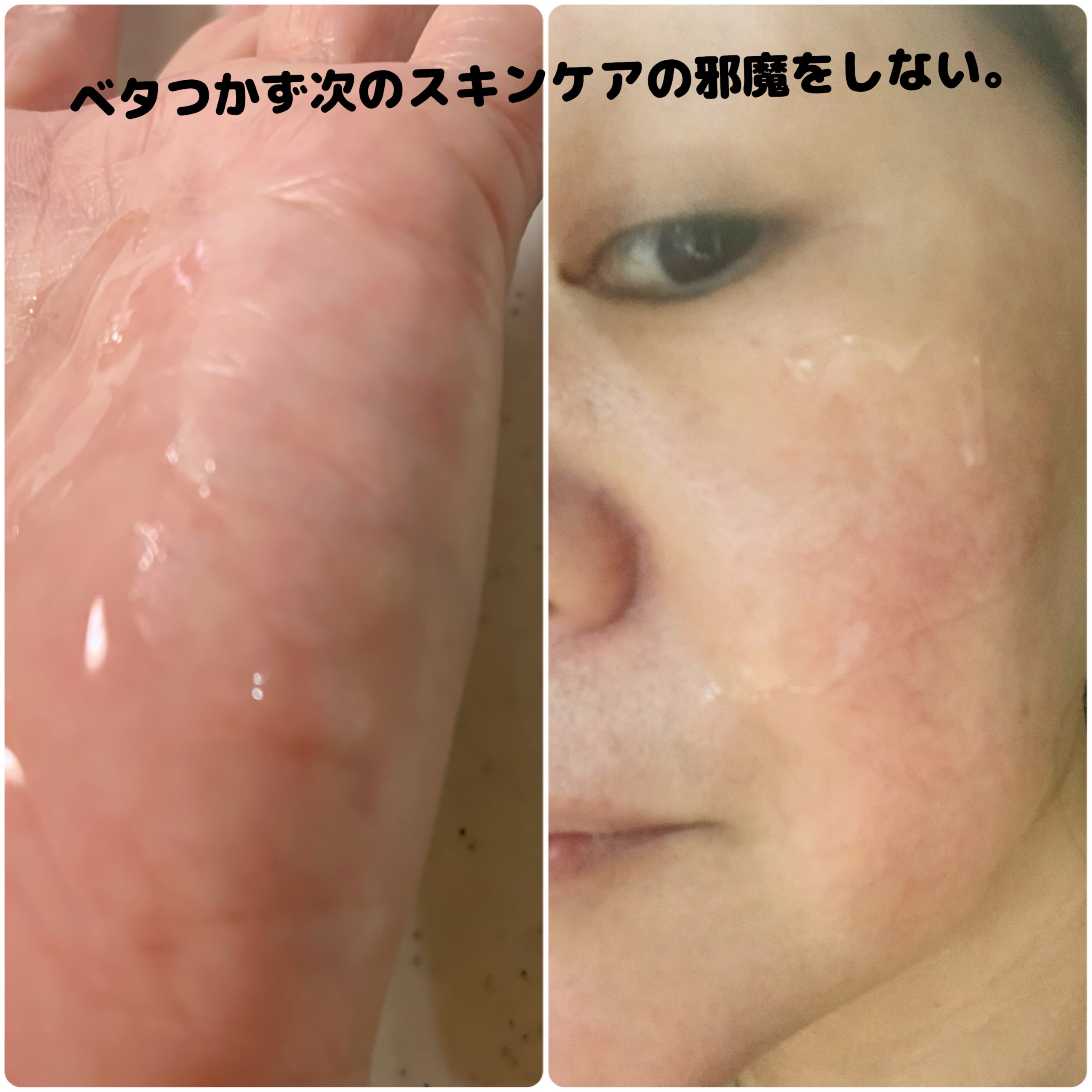 ノスカナイントラブルセラムS/FATION/美容液を使ったクチコミ（3枚目）