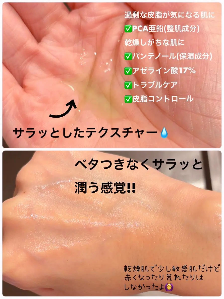 アゼライン酸17セラム/Dr.Melaxin/美容液を使ったクチコミ（2枚目）