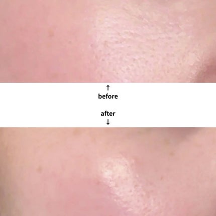 ポアタイトニングアンプル /REJURAN COSMETICS/美容液を使ったクチコミ(2枚目)