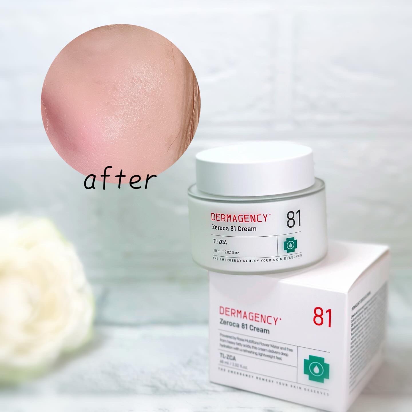 ダーマジェンシー ゼロカ81 クリーム/DERMAGENCY/フェイスクリームを使ったクチコミ（3枚目）