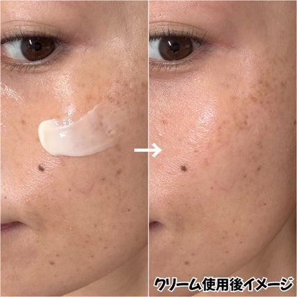 360度ショットPDRNアクティブセラム/センテリアン24/美容液を使ったクチコミ(4枚目)