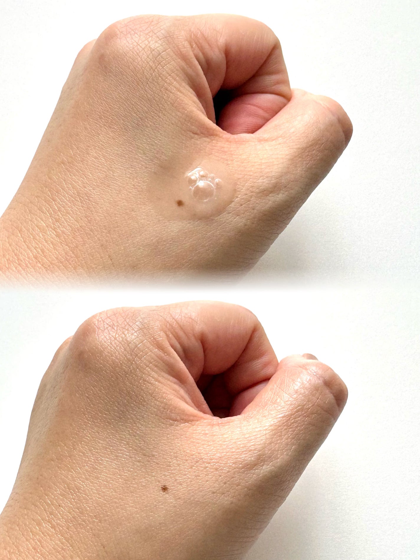 プレミアムビューティーセラム AZELAIC ACID+/CICIBELLA/美容液を使ったクチコミ(4枚目)