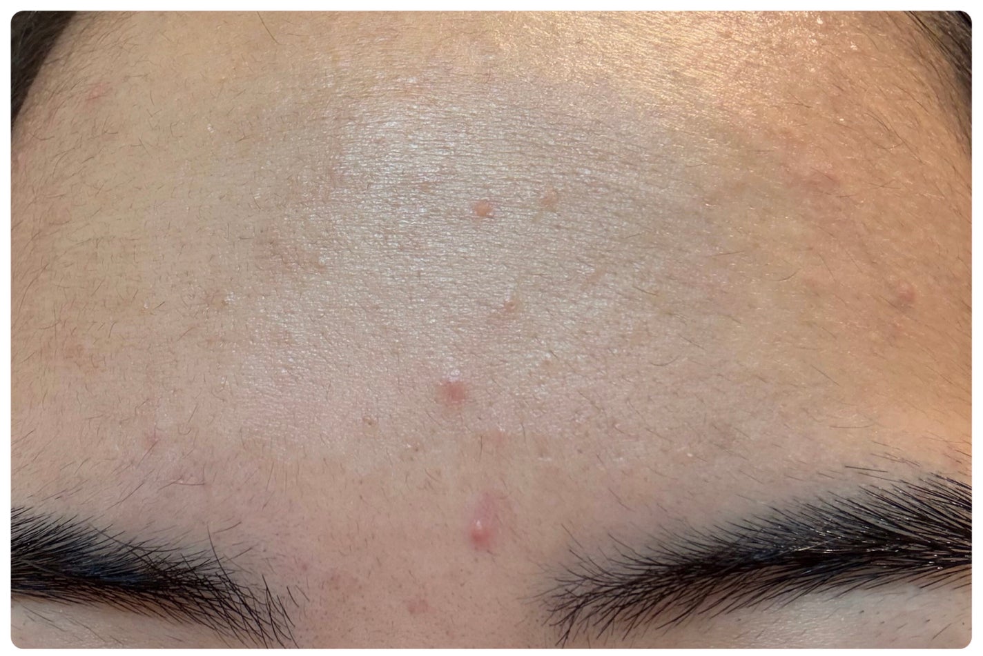 AGE-R ブースタープロ/MEDICUBE/美顔器・マッサージを使ったクチコミ(3枚目)