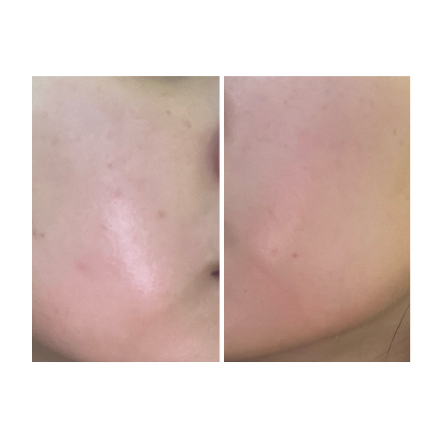 ぽむ on LIPS 「1枚目 2025.9.23エピデュオ 741日目2枚目 202..」(1枚目)