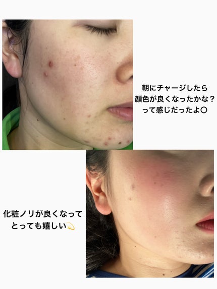 ビタクレンズ/VITALBEAUTIE/美容サプリメントを使ったクチコミ(4枚目)