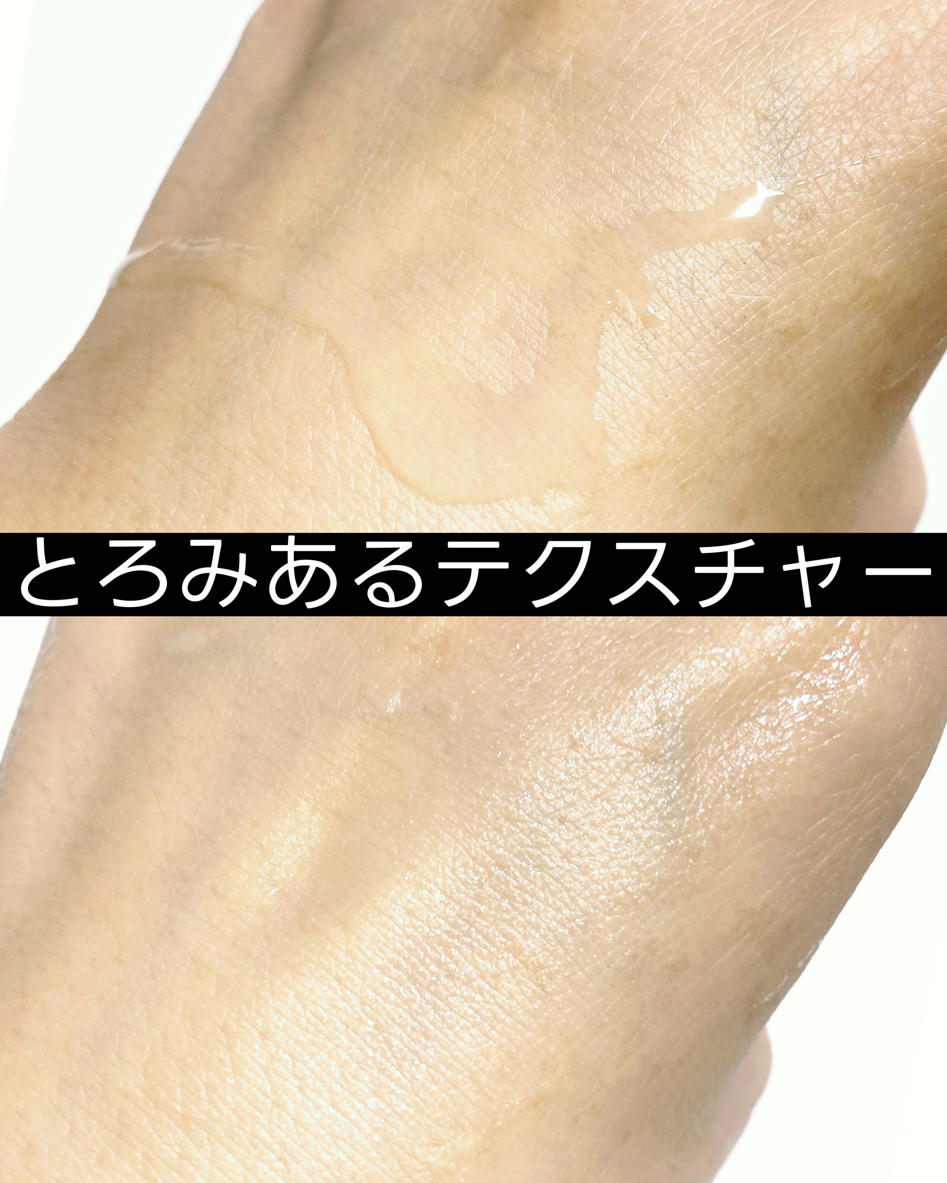 エファクラ ピールケア セラム/ラ ロッシュ ポゼ/美容液を使ったクチコミ（3枚目）