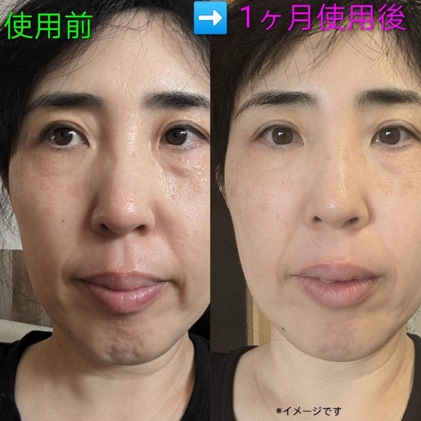 ルルルン ハイドラ PD マスク/ルルルン/シートマスク・パックを使ったクチコミ(6枚目)